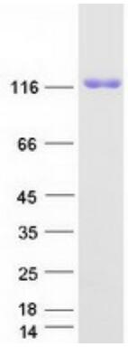 Coomassie blue staining of purified EPHA2 protein.